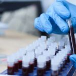 Wetenschappers Ontdekken het Zeldzaamste Bloedtype Ter Wereld!